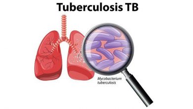 Photo of 3 Kmr dist. in ‘gold’ list of highest TB reduction