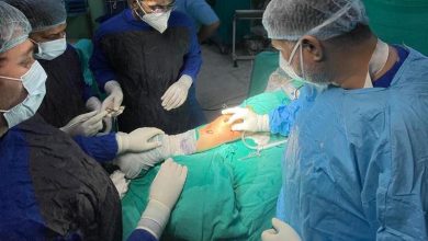 Photo of MPFL reconstruction successfully performed on 18-year-old at ASCOMS Hospital
