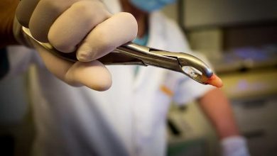 Photo of At 37.5 mm, doctors in central Kashmir might have extracted the world’s longest tooth