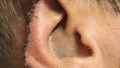Photo of Teacher arrested in Kashmir after ‘biting colleague’s ear’
